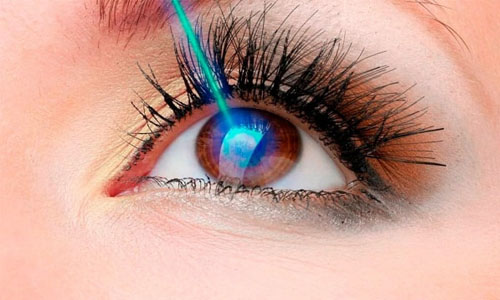_0002_refrativa.jpg